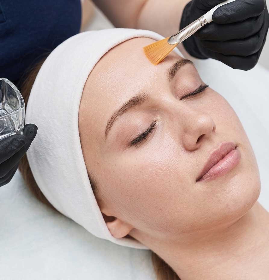 Chemical Peel Frisco TX | Medical-Grade Skin Resurfacing