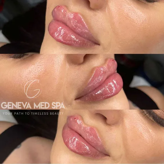 Geneva Med Spa aesthetic clinic in Frisco TX