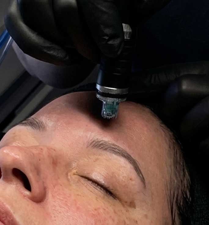 Signature facial treatment at Geneva Med Spa in Frisco TX