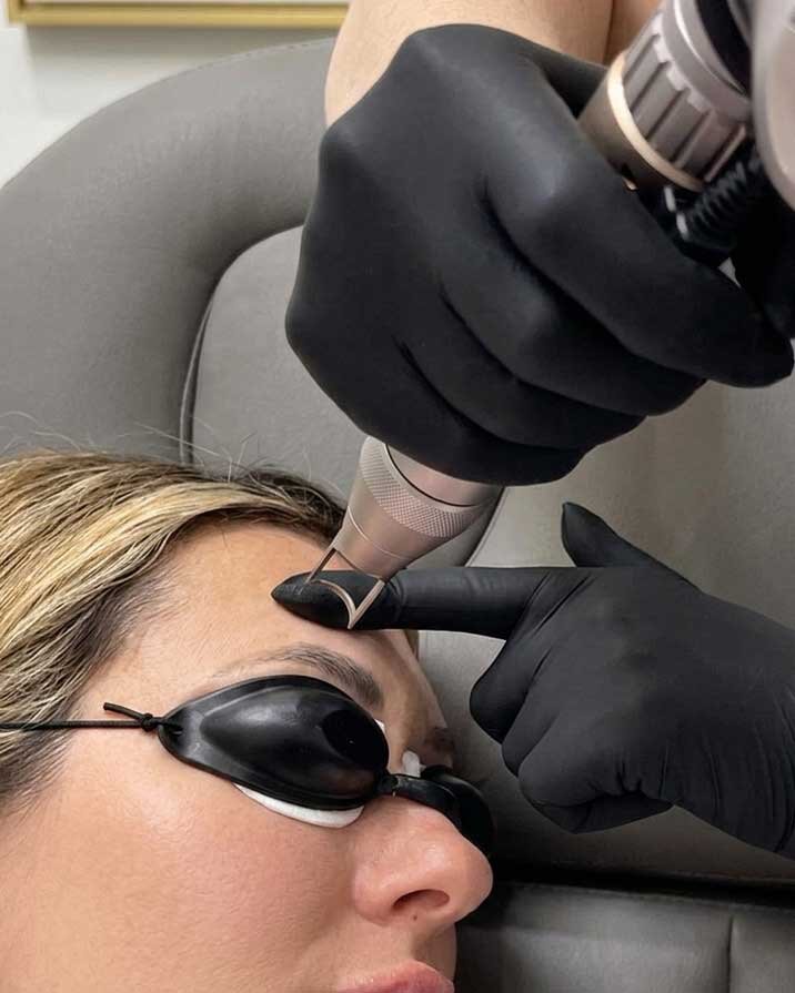 Laser Tattoo Removal Frisco TX | Fading & Full Removal