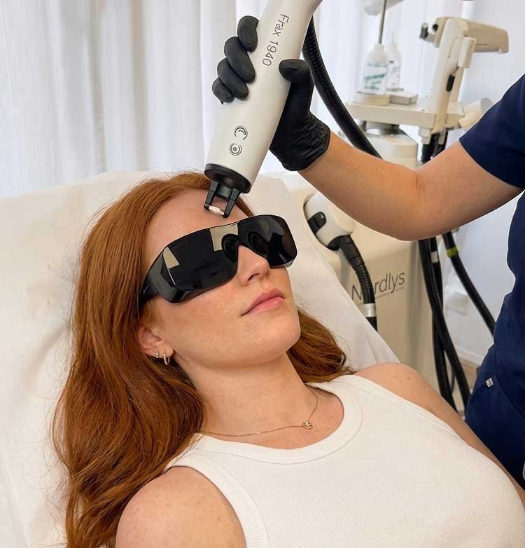 Fractional Laser Resurfacing Frisco TX | Fraxel Treatment