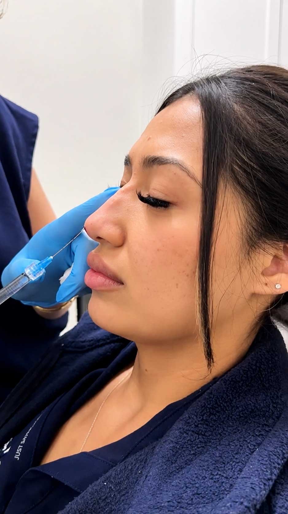 Liquid Rhinoplasty Frisco TX | Non-Surgical Nose Job