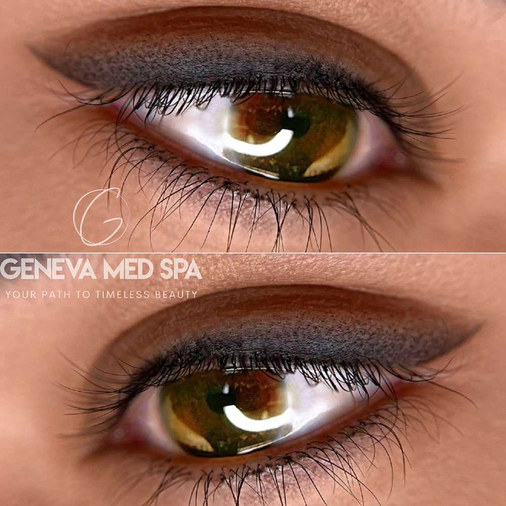 Permanent makeup treatments at Geneva Med Spa in Frisco TX