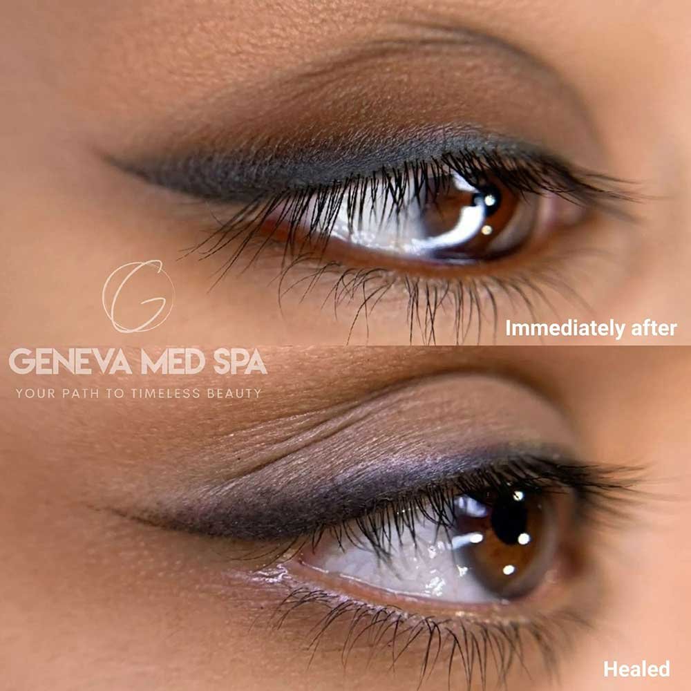 Permanent-Eyeliner-Frisco-gallery