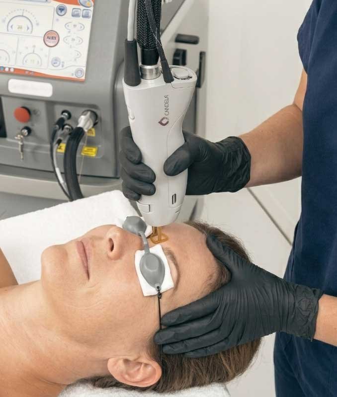 Laser Vein Removal Frisco TX | Spider Veins & Broken Capillaries