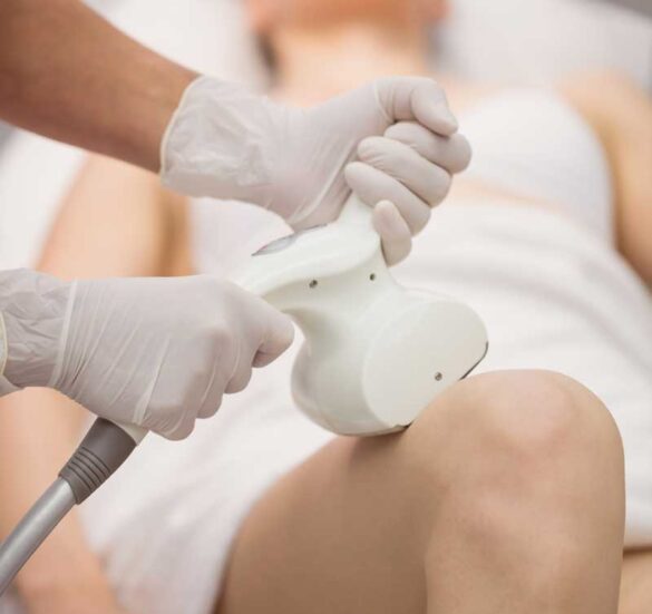 Laser-Hair-Removal-at-Geneva-Med-Spa-in-Texas