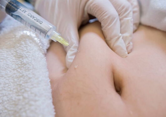 Deoxycholic Acid Injections for Stubborn Fat Melting Deoxycholic Acid Injections for Stubborn Fat Melting