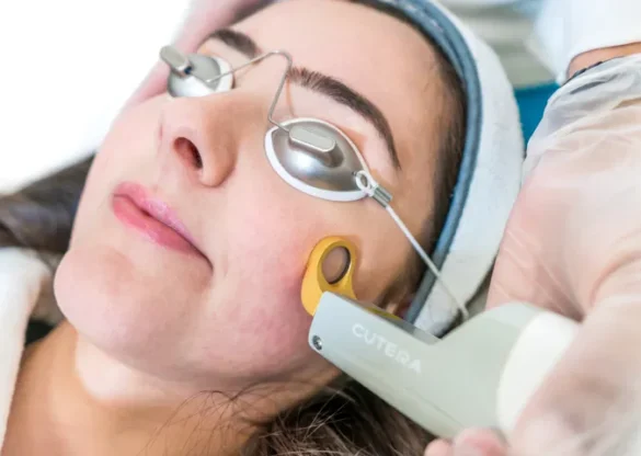 laser skin treatment laser skin treatment