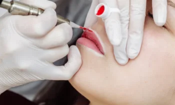 lip pigmentation lip pigmentation