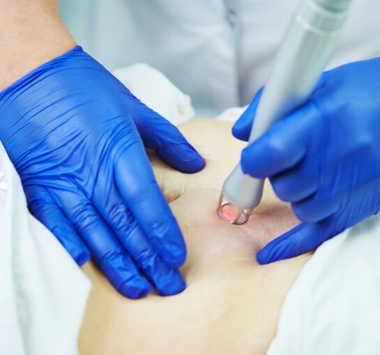 Laser cosmetic surgery and skin resurfacing in dermatology