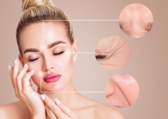 dermal fillers