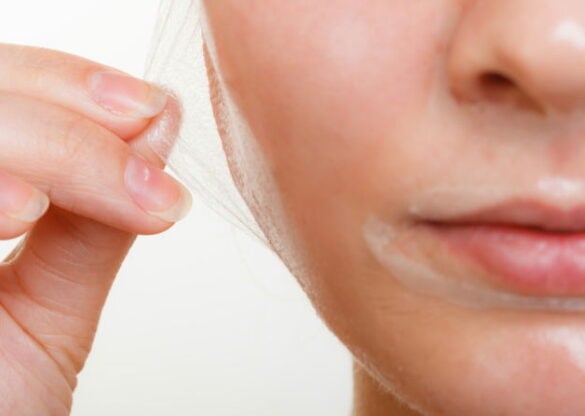 Microdermabrasion & Peel